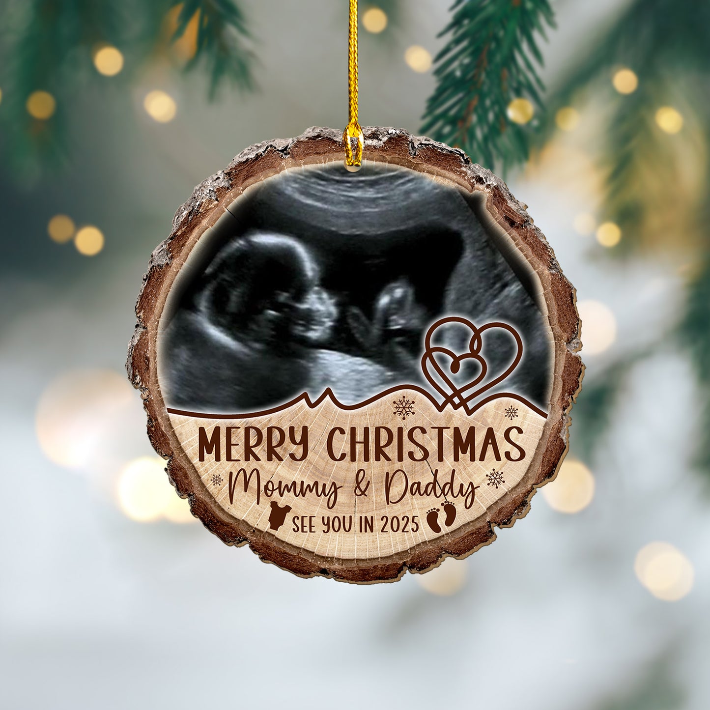 Custom Baby Ultrasound Photo Wood Slice Ornament