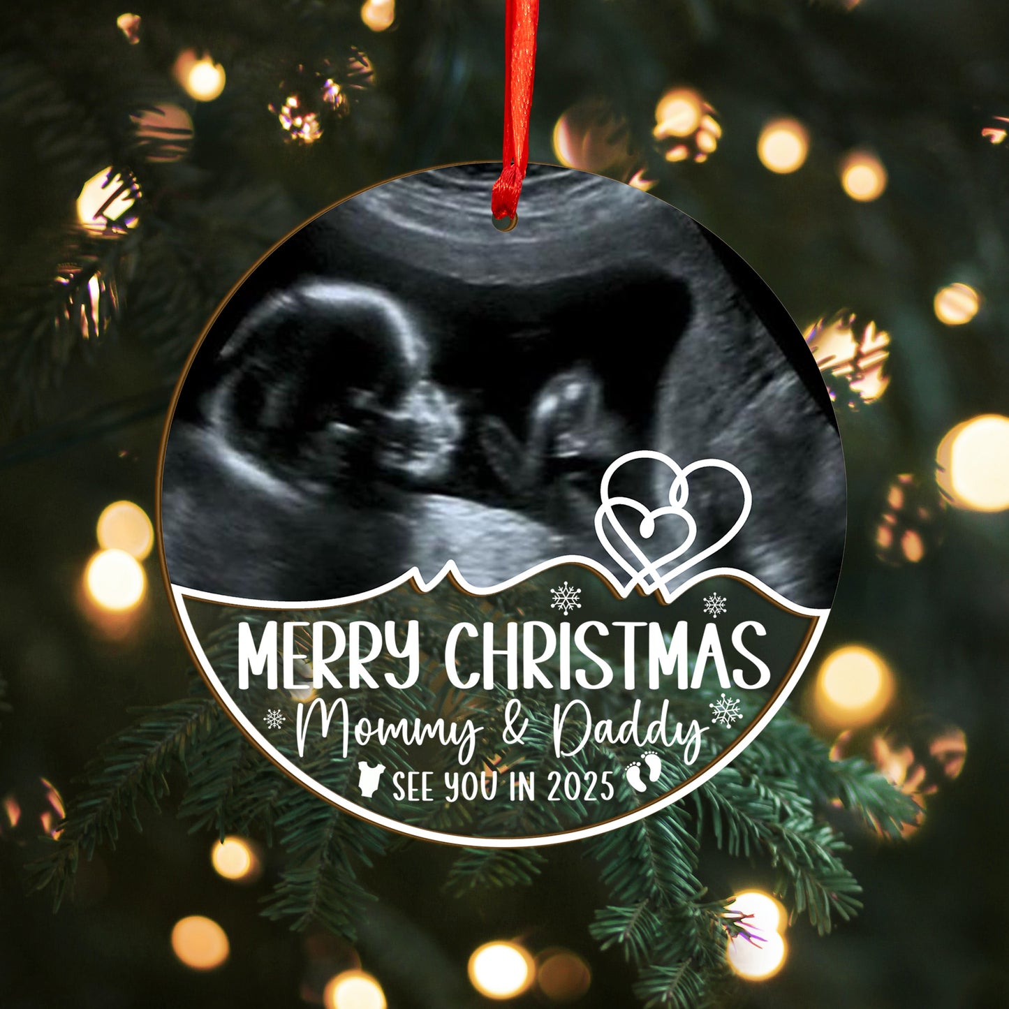 Custom Ultrasound Photo Baby Wood and Acrylic Ornament