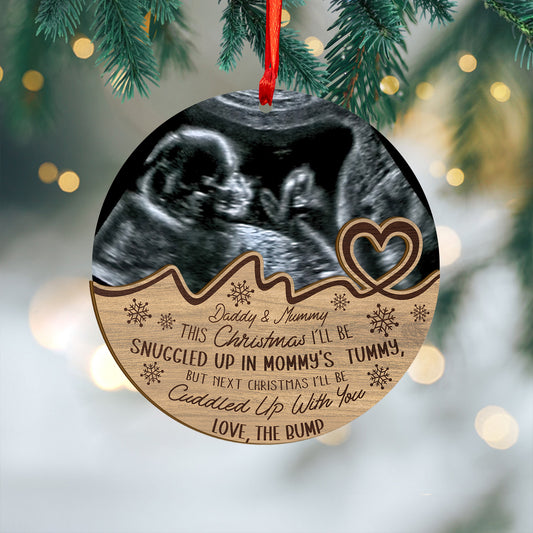 Custom Baby Ultrasound Photo Wood and Acrylic Ornament