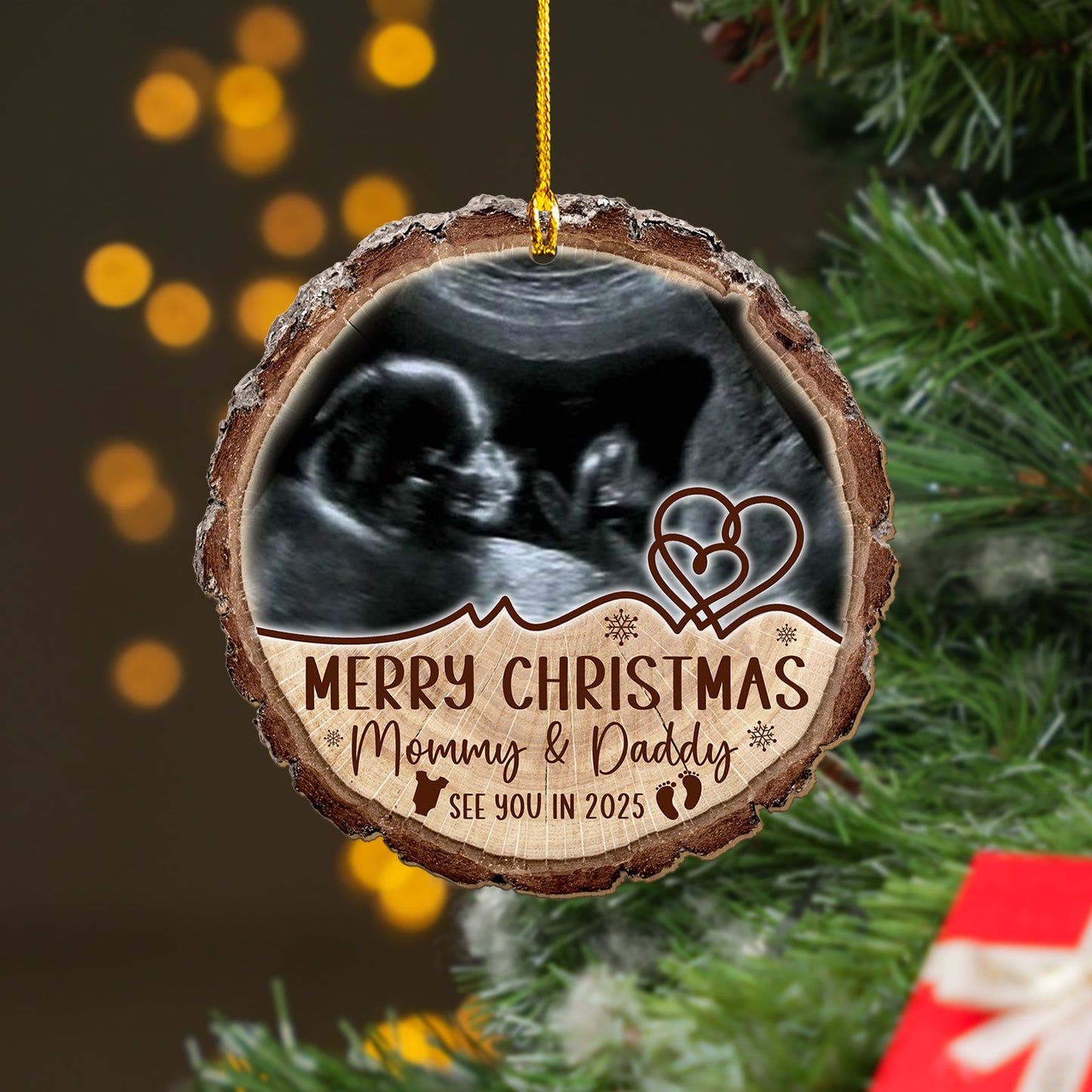 Custom Baby Ultrasound Photo Wood Slice Ornament