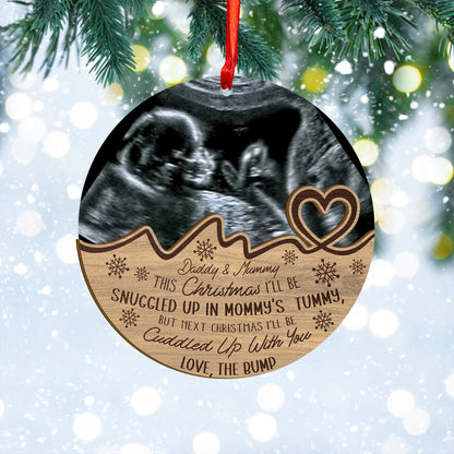 Custom Baby Ultrasound Photo Wood and Acrylic Ornament