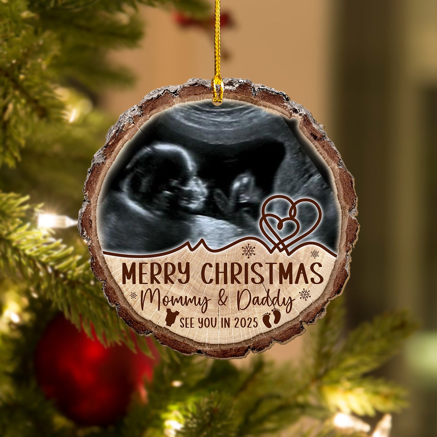 Custom Baby Ultrasound Photo Wood Slice Ornament