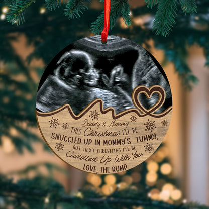 Custom Baby Ultrasound Photo Wood and Acrylic Ornament