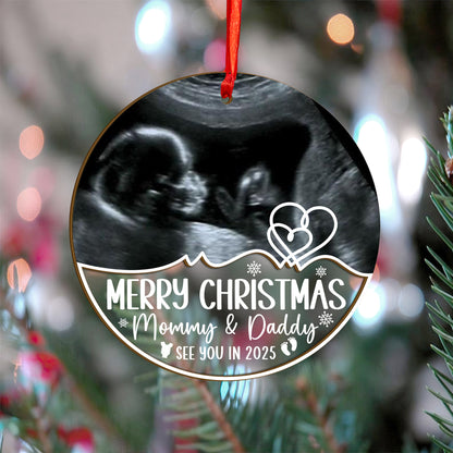 Custom Ultrasound Photo Baby Wood and Acrylic Ornament