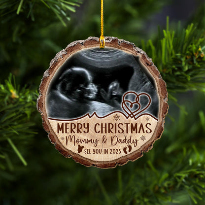 Custom Baby Ultrasound Photo Wood Slice Ornament