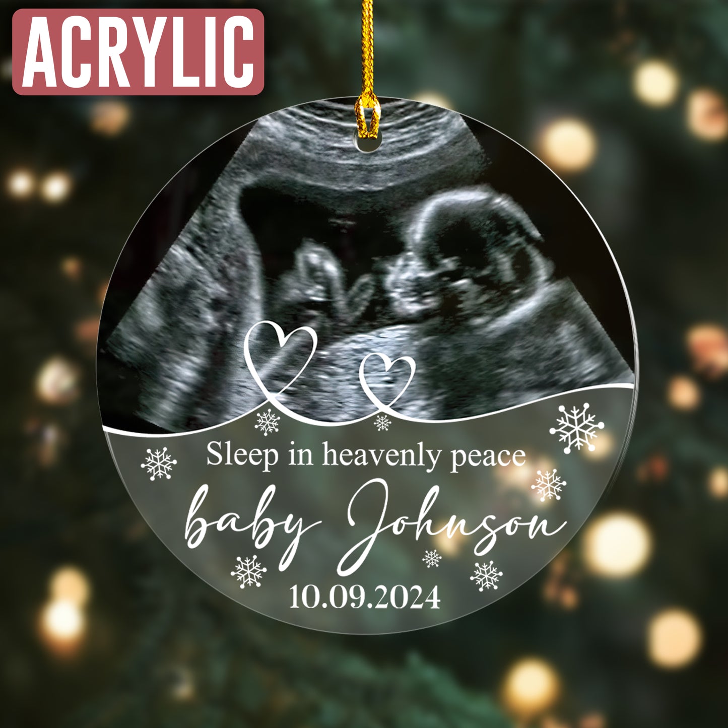 Custom Ultrasound Photo Memorial Ornament