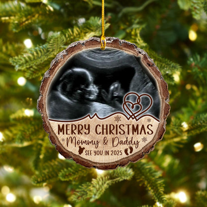 Custom Baby Ultrasound Photo Wood Slice Ornament