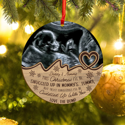 Custom Baby Ultrasound Photo Wood and Acrylic Ornament