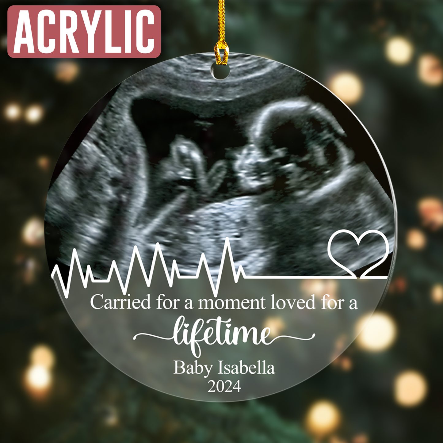 Custom Miscarriage Baby Ultrasound Photo Ornament