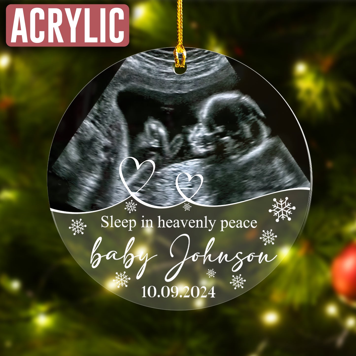 Custom Ultrasound Photo Memorial Ornament