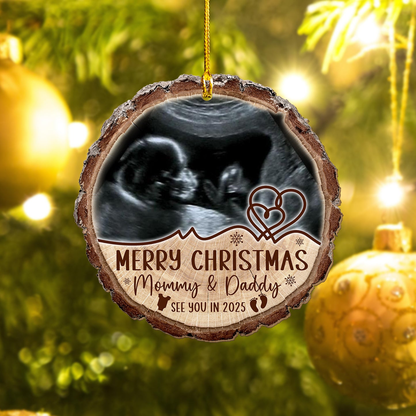 Custom Baby Ultrasound Photo Wood Slice Ornament