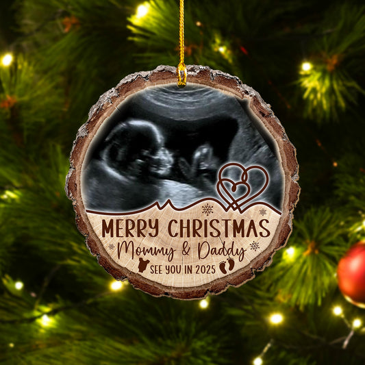 Custom Baby Ultrasound Photo Wood Slice Ornament