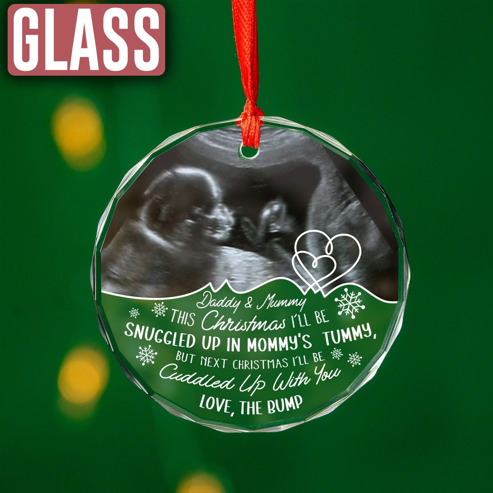 Custom Photo Baby Ultrasound Ornament