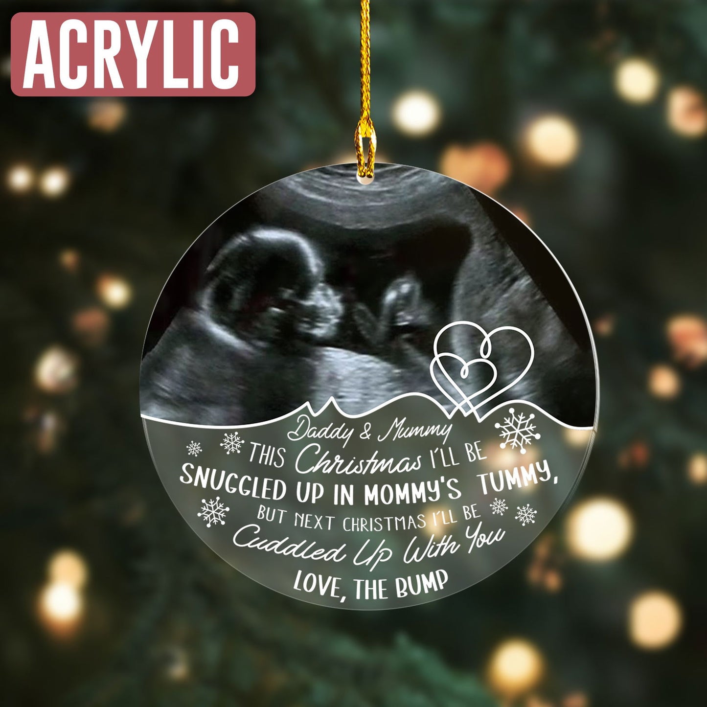 Custom Photo Baby Ultrasound Ornament