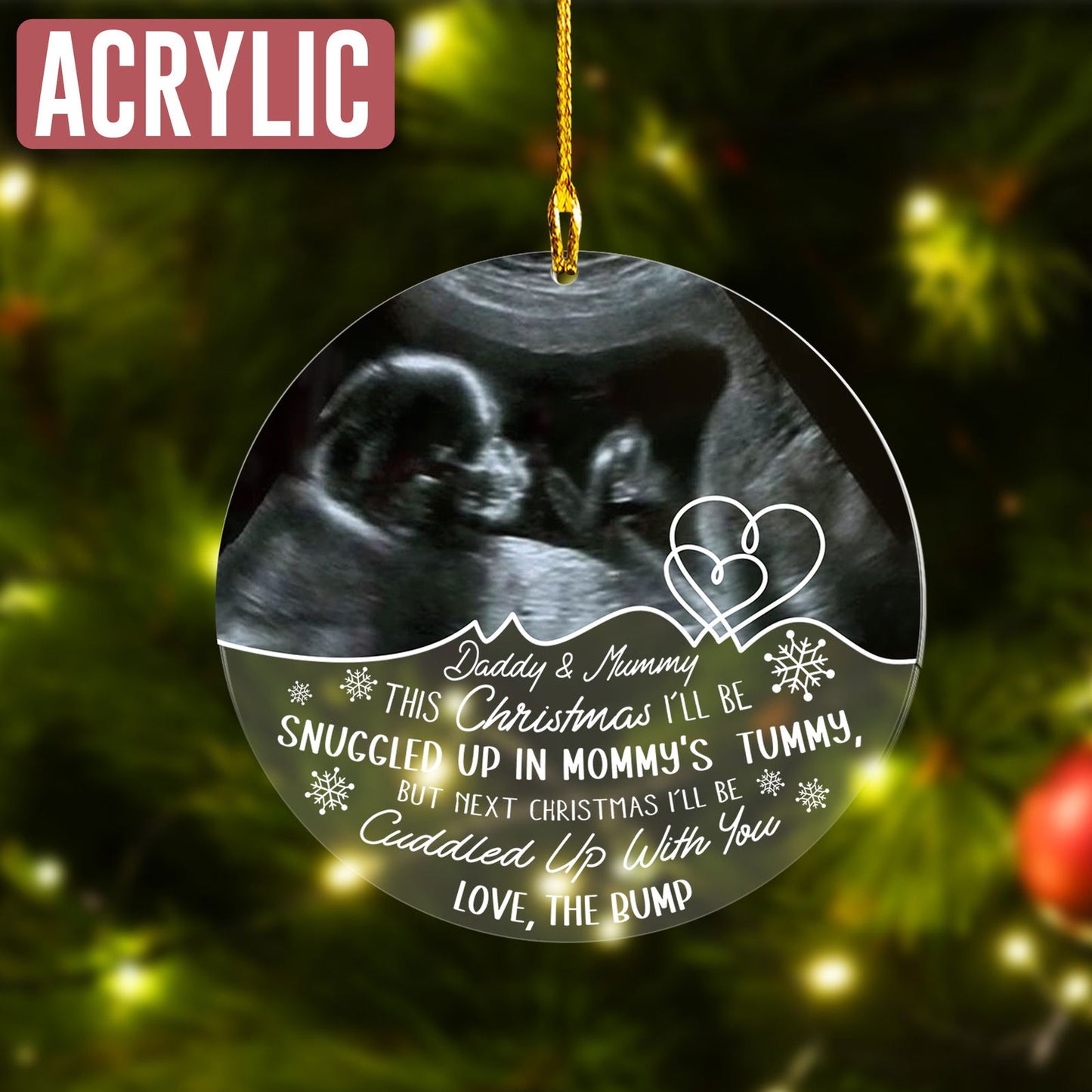 Custom Photo Baby Ultrasound Ornament