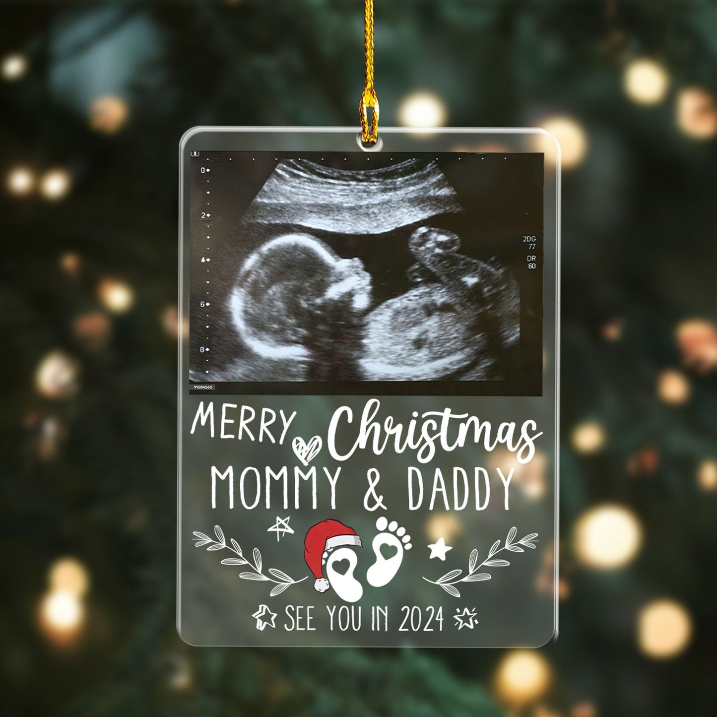 Custom Photo Baby Ultrasound Ornament