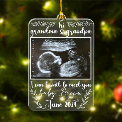 Custom Photo Ultrasound Baby Ornament