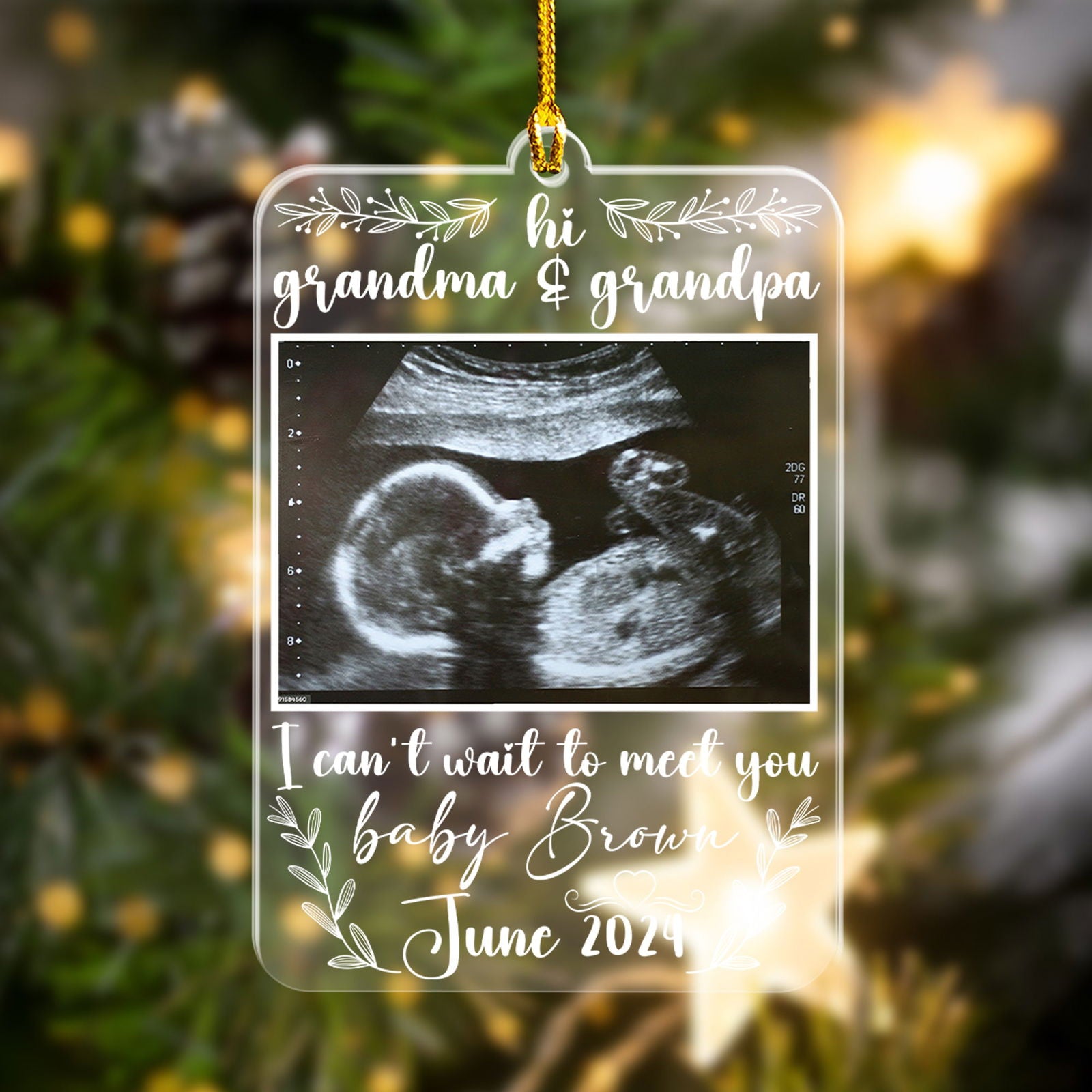 Custom Photo Ultrasound Baby Ornament