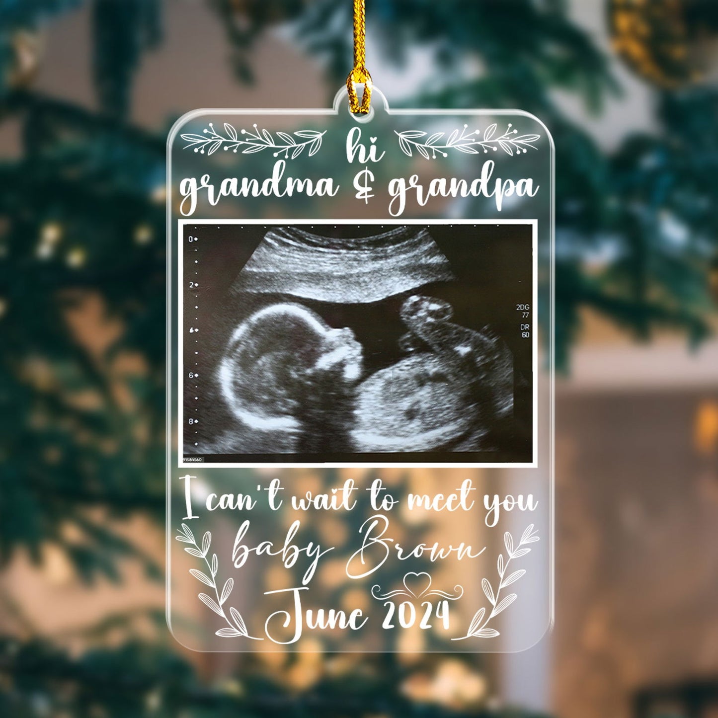 Custom Photo Ultrasound Baby Ornament