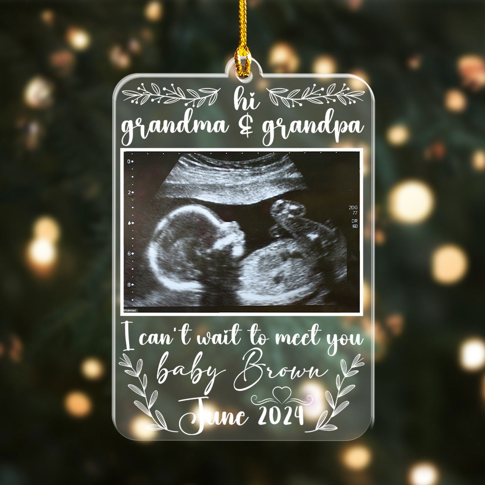 Custom Photo Ultrasound Baby Ornament