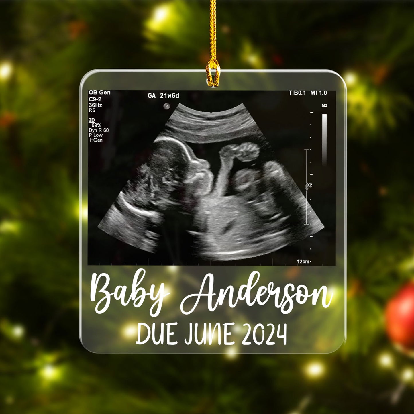 Custom Photo Ultrasound Baby With Name Ornament