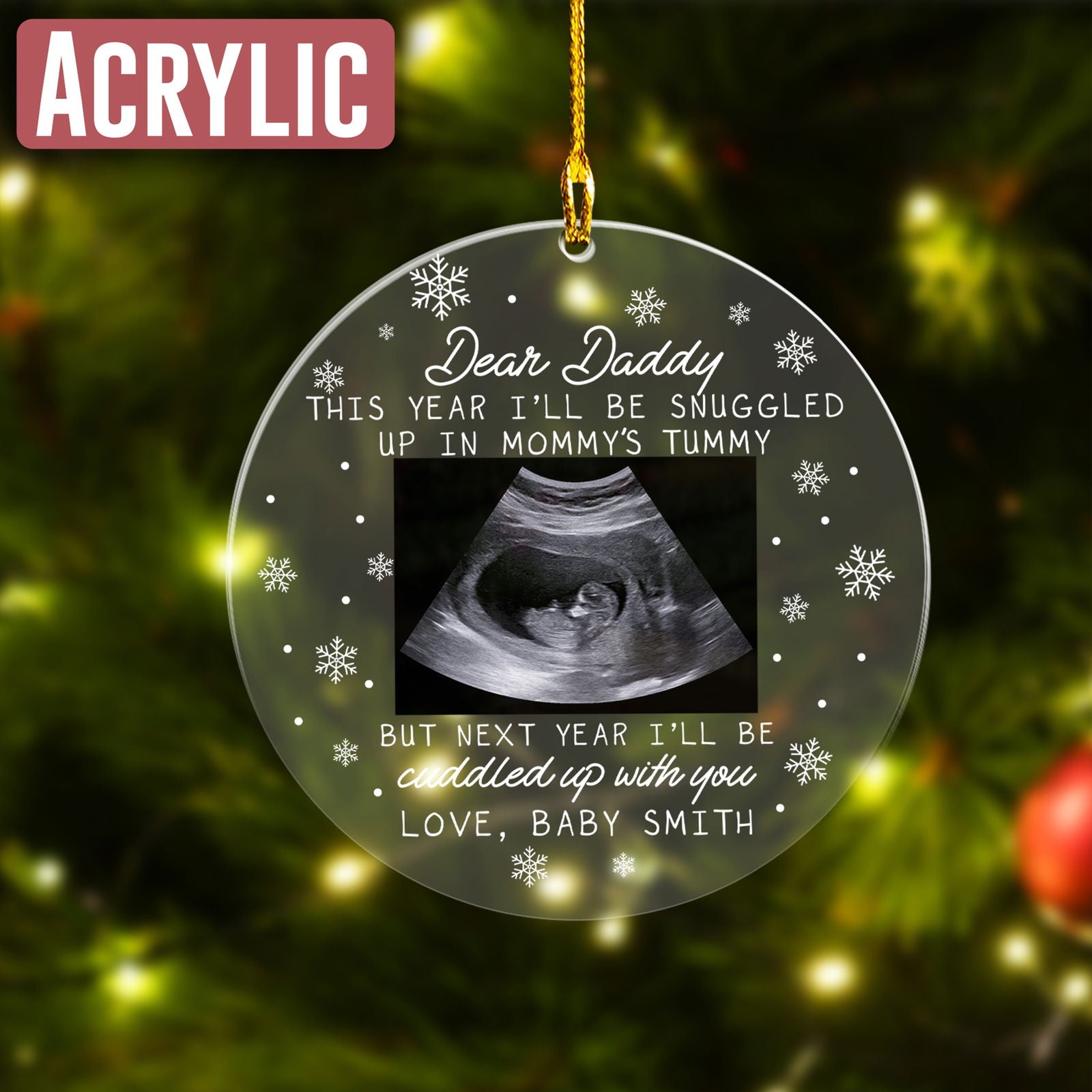 Custom Photo Ultrasound Ornament