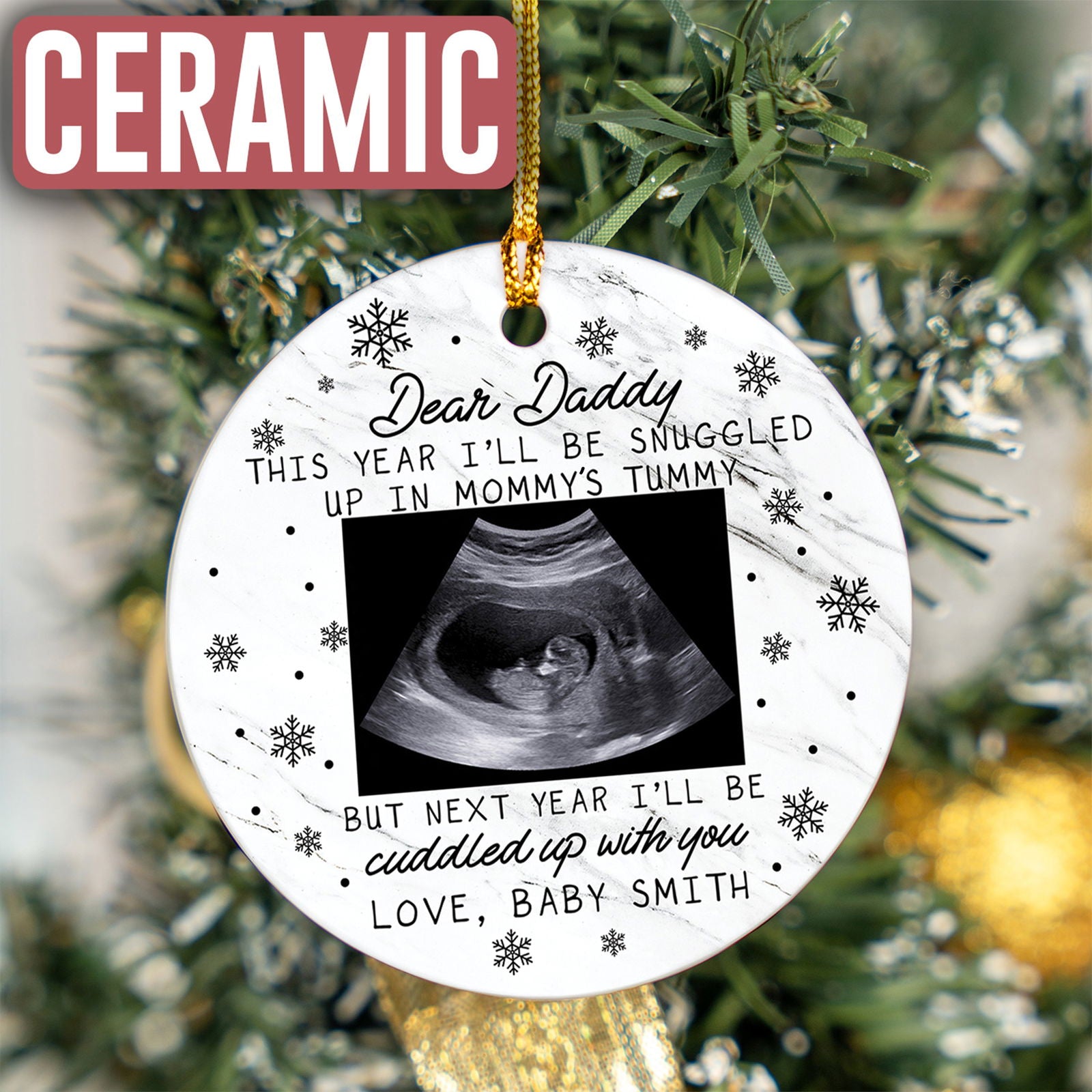 Custom Photo Ultrasound Ornament