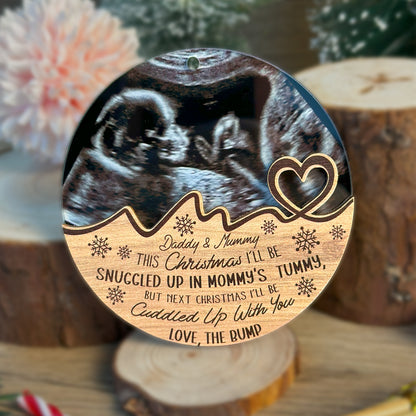 Custom Baby Ultrasound Photo Wood and Acrylic Ornament